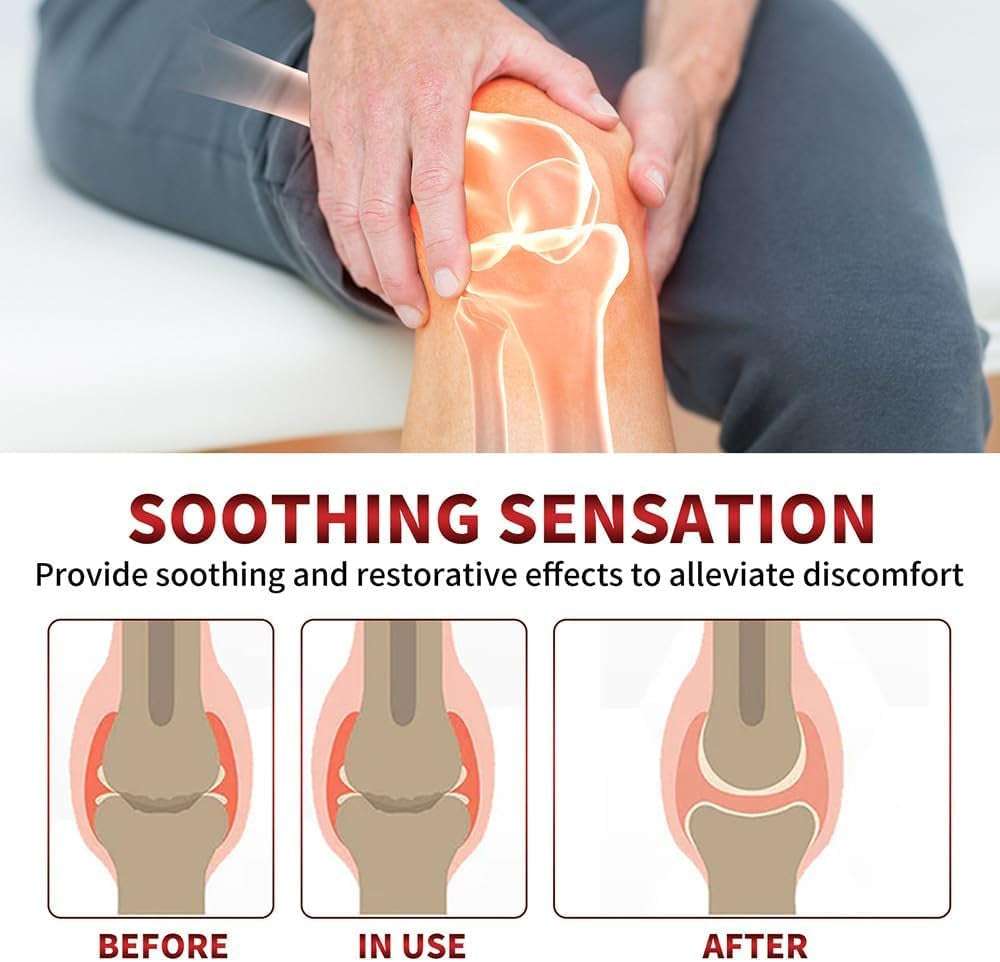 Todahof Bee Venom Pain Relief & Bone Healing Cream - 5 Pack Natural Pain Relief Salve